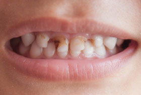 child dentistry porbandar