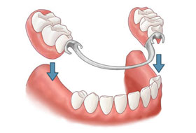dentures clinic in porbandar